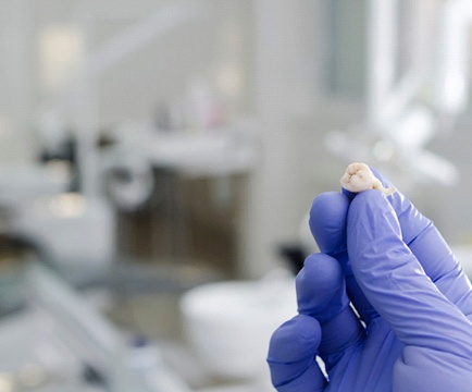 Dentist holding tooth after performing tooth extractions in Baltimore